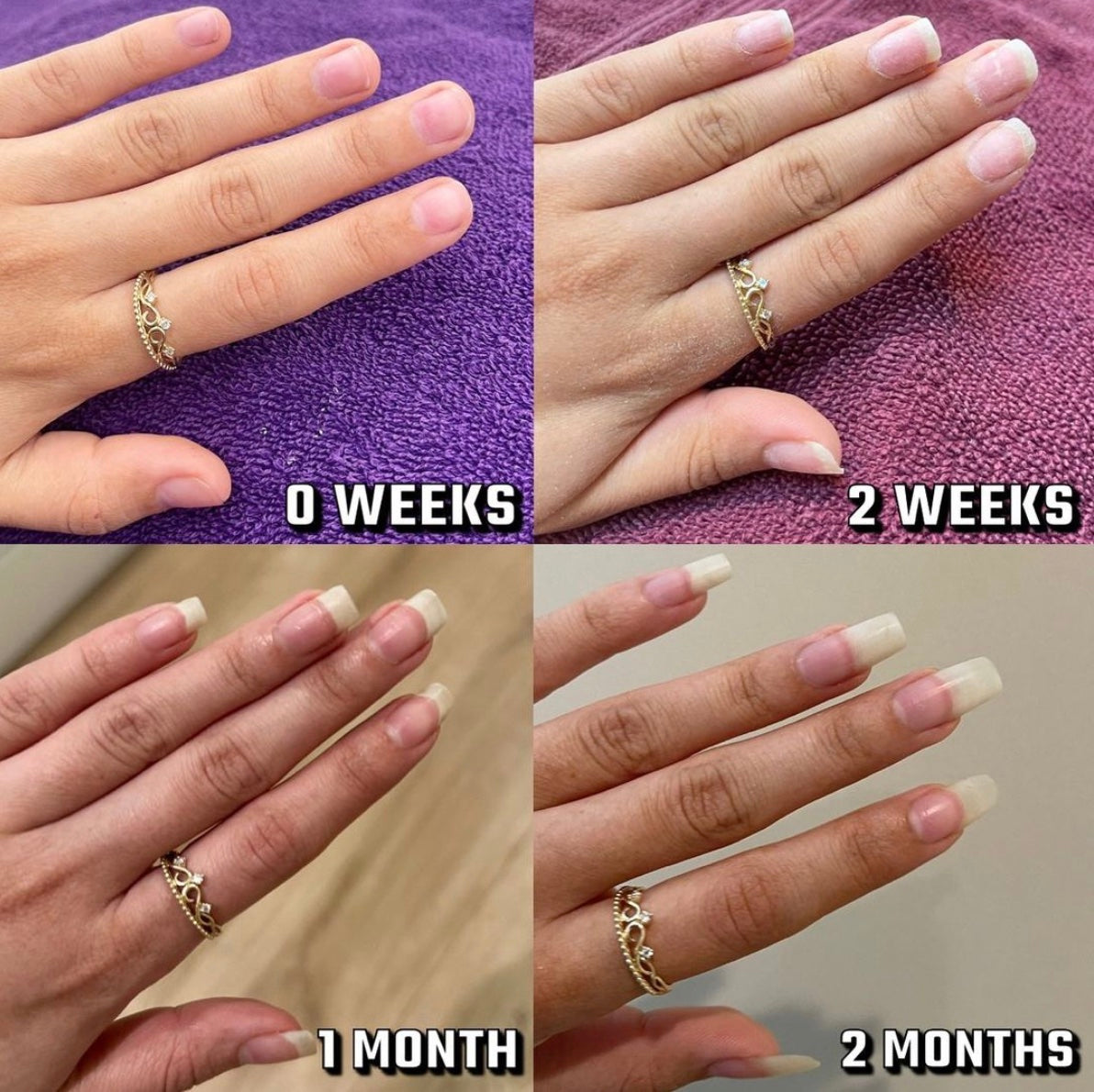 Revitaliseer Nagelgroei met Stamcellen Pen