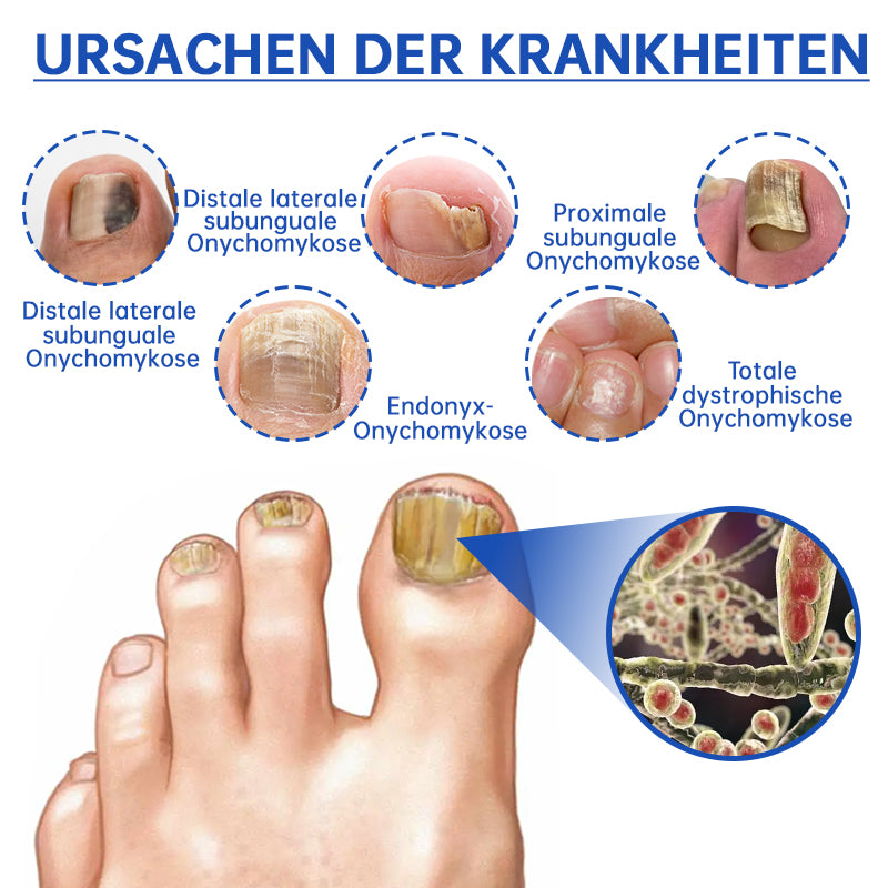 NailCure