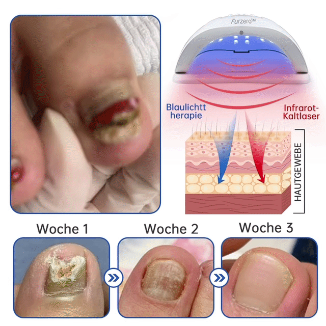 NailCure
