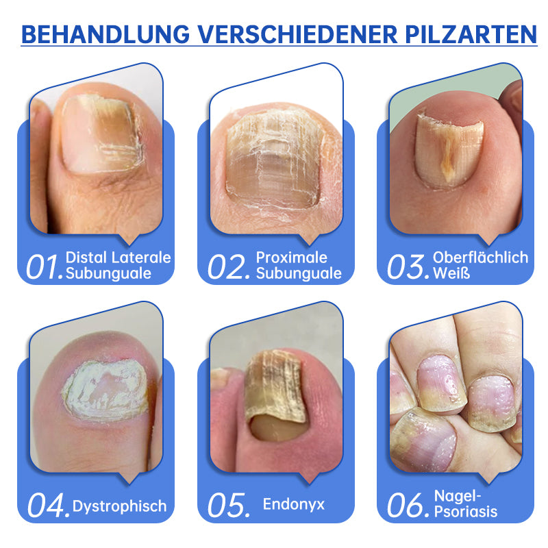 NailCure