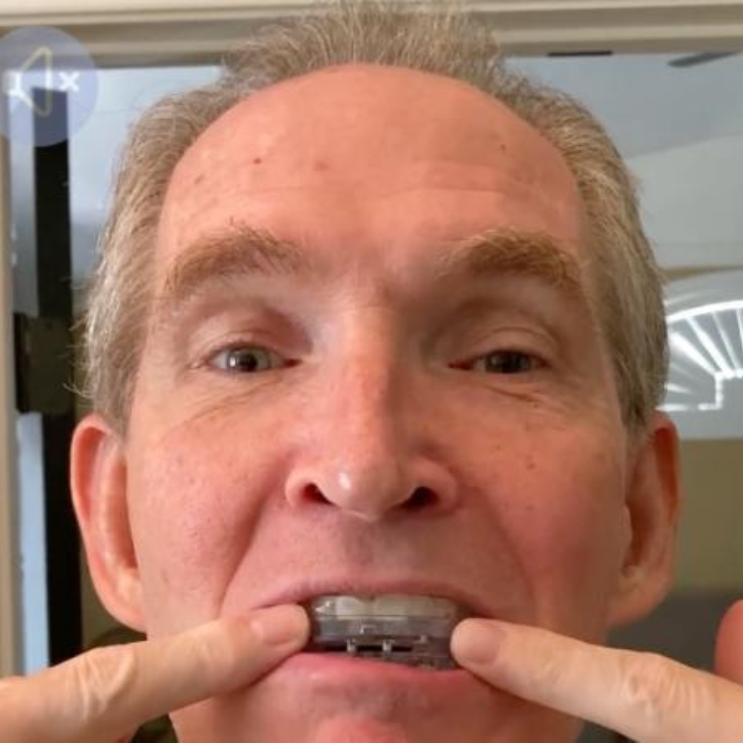 MOUTHPIECE | SleepComfort